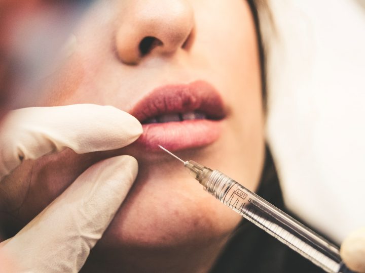 Botox – Usage, Procedure, and Possible Side Effects