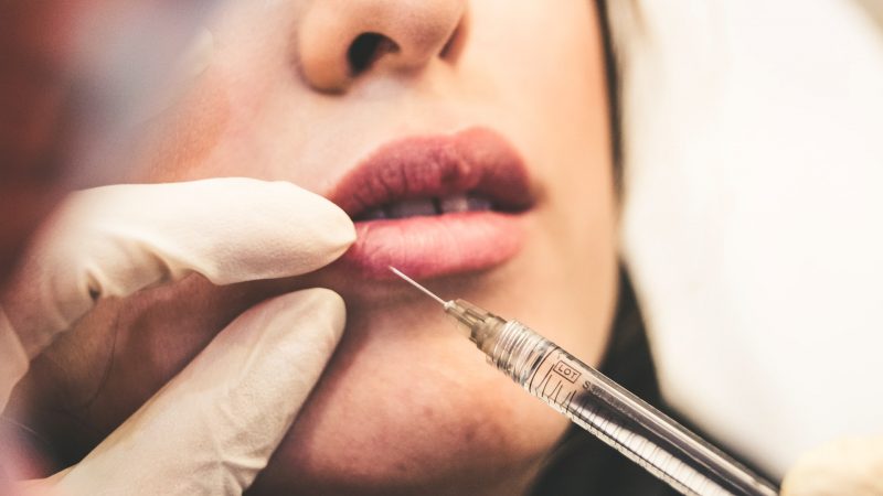 Botox – Usage, Procedure, and Possible Side Effects